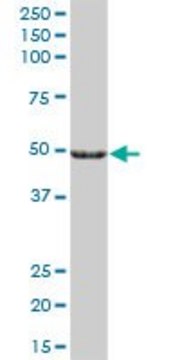 Anti-CYP27A1 antibody produced in mouse