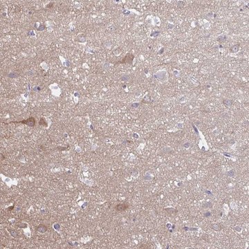 Anti-HYPK antibody produced in rabbit