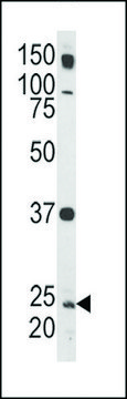 ANTI-RAB5(C-TERMINAL) antibody produced in rabbit