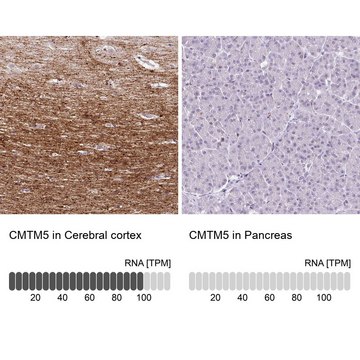 Anti-CMTM5 antibody produced in rabbit