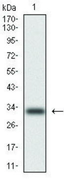 Monoclonal Anti-Cytokeratin 5 antibody produced