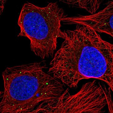 Anti-AEBP1 antibody produced in rabbit