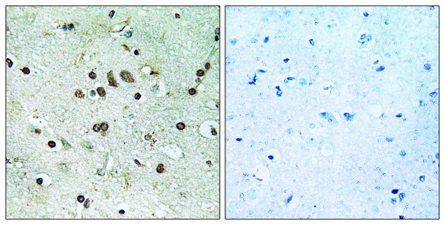 Anti-BTF3L4 antibody produced in rabbit