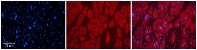 Anti-OTUD7B antibody produced in rabbit