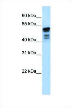 Anti-DES antibody produced in rabbit