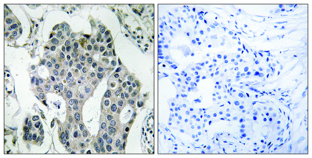 Anti-RAB3GAP2 antibody produced in rabbit