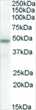 Anti-SERPINA12 antibody produced in goat