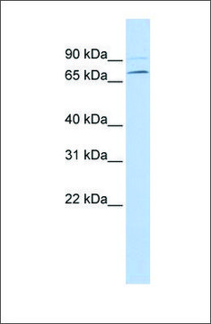 Anti-YTHDF3 (ab1) antibody produced in