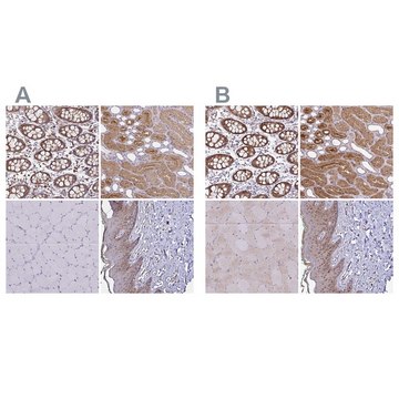 Anti-TXN antibody produced in rabbit