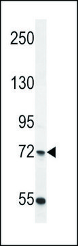 ANTI-C2ORF39 (C-TERM) antibody produced in