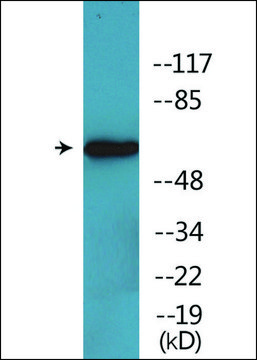 Anti-phospho-RIPK2 (pSer¹??) antibody produced in