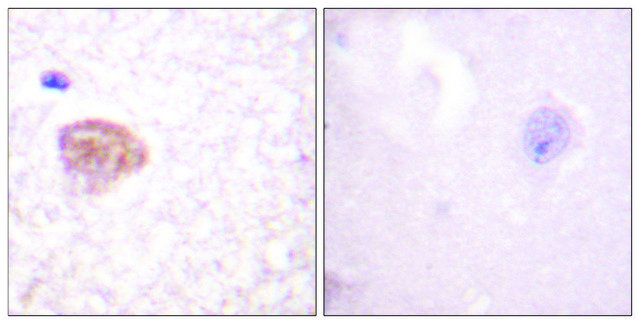 Anti-DDX3 antibody produced in rabbit