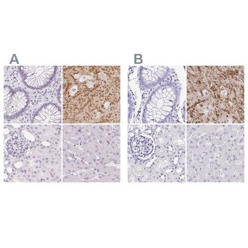 Anti-SYNPR antibody produced in rabbit