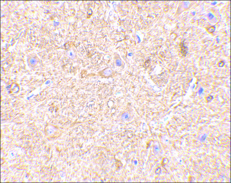 Anti-VISA (ab2) antibody produced in