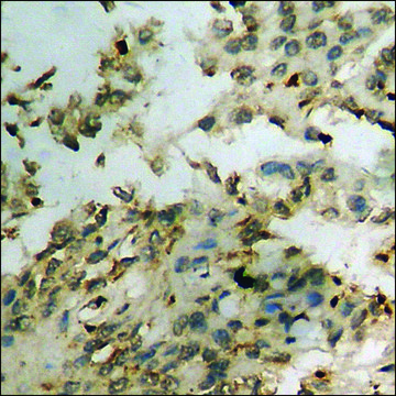 Anti-phospho-NF-kappaB p105/p50 (pSer??³) antibody produced