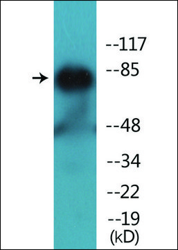 Anti-phospho-PKC ? (pThr?³?) antibody produced