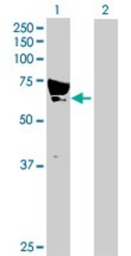 Anti-CAMKK1 antibody produced in rabbit