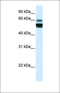 Anti-SMPD1 antibody produced in rabbit