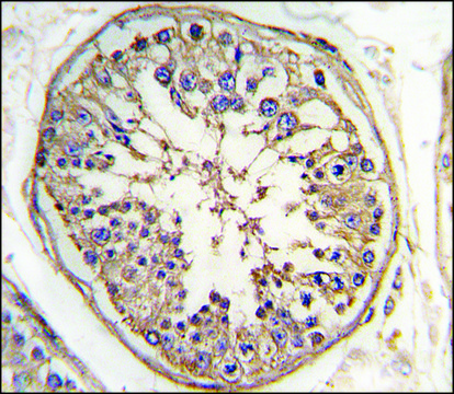 Anti-MARS2 (N-term) antibody produced in