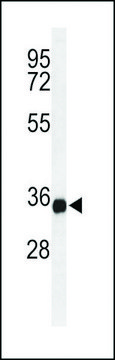 ANTI-TM173(C-TERMINAL) antibody produced in rabbit