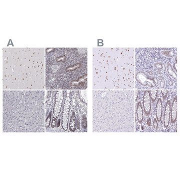 Anti-HNRNPA0 antibody produced in rabbit