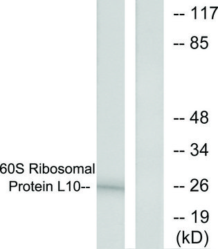 Anti-60S Ribosomal Protein L10, N-Terminal