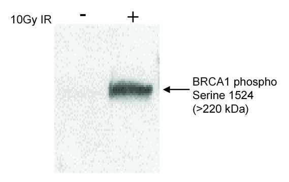 Rabbit anti-Phospho BRCA1 (S1524) Antibody,
