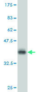 Monoclonal Anti-PRKCD, (C-terminal) antibody produced