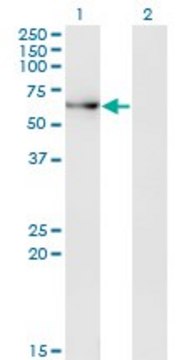 Monoclonal Anti-ACD antibody produced in