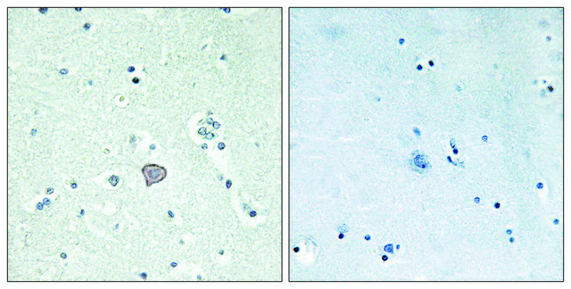 Anti-ADORA2A antibody produced in rabbit