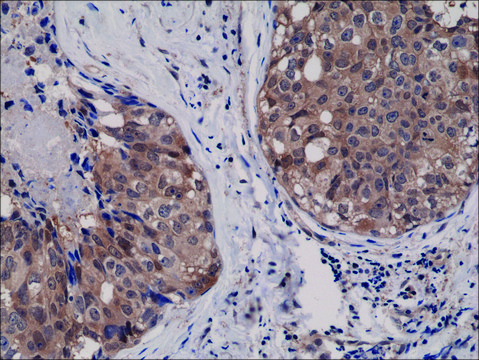 Anti-AKT1 antibody, Rabbit monoclonal