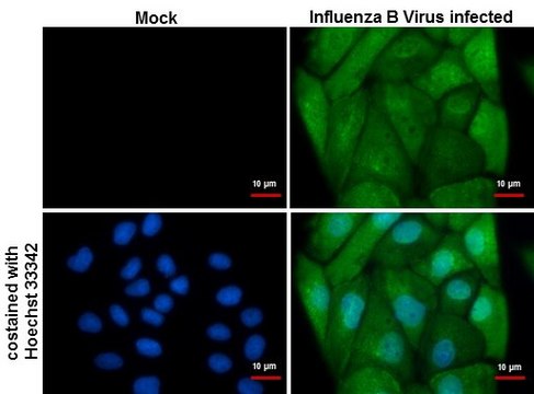 Monoclonal Anti-Influenza B Virus NP