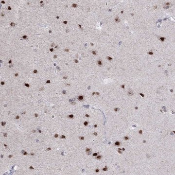 Anti-HES5 antibody produced in rabbit