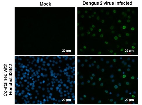 Monoclonal Anti-Dengue virus Type 2