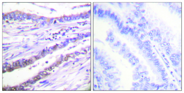 Anti-Cyclin A antibody produced in