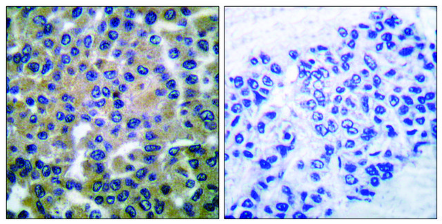 Anti-SYK antibody produced in rabbit