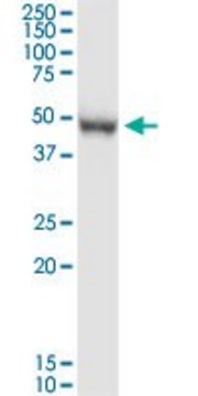 Anti-PRMT8 antibody produced in rabbit