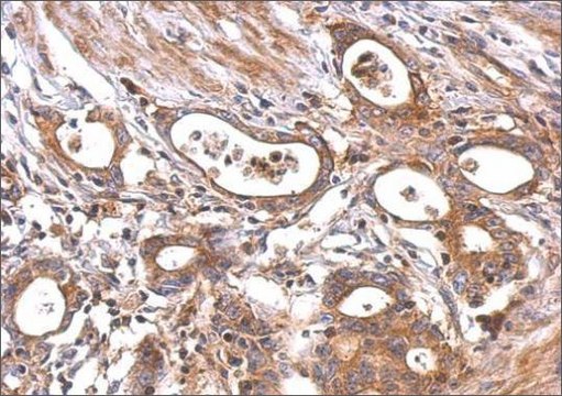 Anti-MC1R (C-terminal) antibody produced in