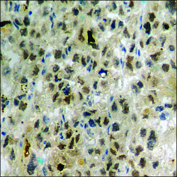 Anti-phospho-ARHGDIA (pSer¹??) antibody produced in