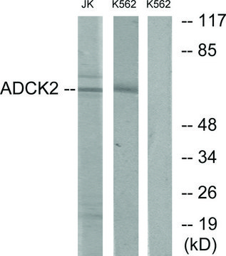 Anti-ADCK2 antibody produced in rabbit