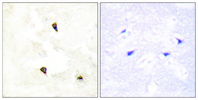 Anti-TP53I11 antibody produced in rabbit