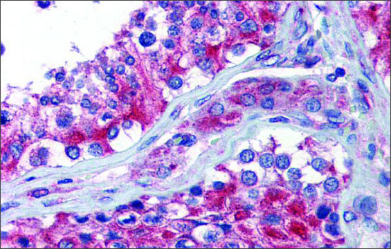 Anti-NPY1R antibody produced in rabbit