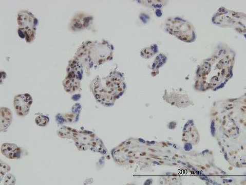 ANTI-RUNX2 antibody produced in mouse