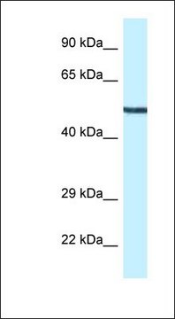 Anti-MAP2K5 antibody produced in rabbit