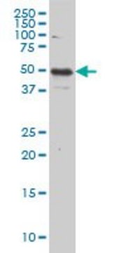 Monoclonal Anti-IL13RA2 antibody produced in