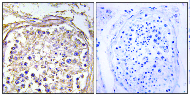 Anti-CHST9, C-Terminal antibody produced in
