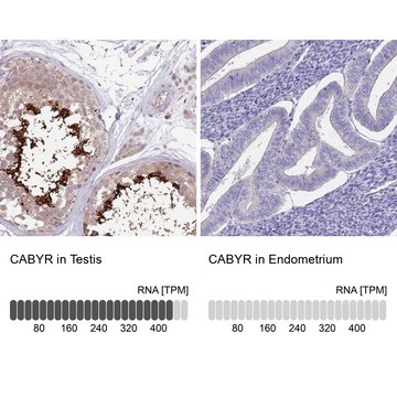 Anti-CABYR antibody produced in rabbit