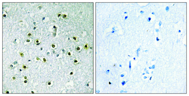 Anti-TFE3 antibody produced in rabbit