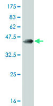 ANTI-RARA antibody produced in mouse