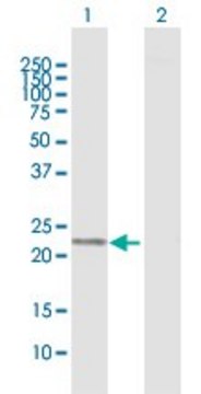 Anti-PGDS antibody produced in rabbit